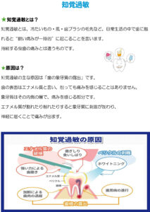 知覚過敏-1